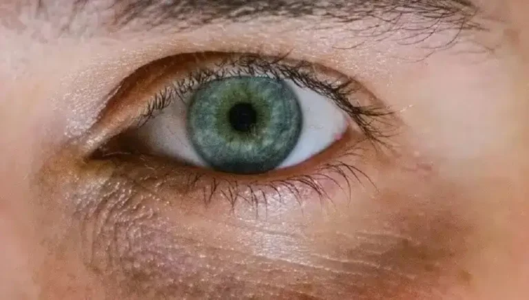 Recupera el brillo de tu mirada
