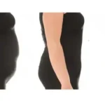 Descubre las diferencias entre la Cavitación y la Hidrolipoclasia