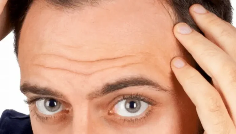 deja de perder el cabello