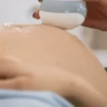 Diabetes gestacional: causas, síntomas y tratamientos. Sants Institut