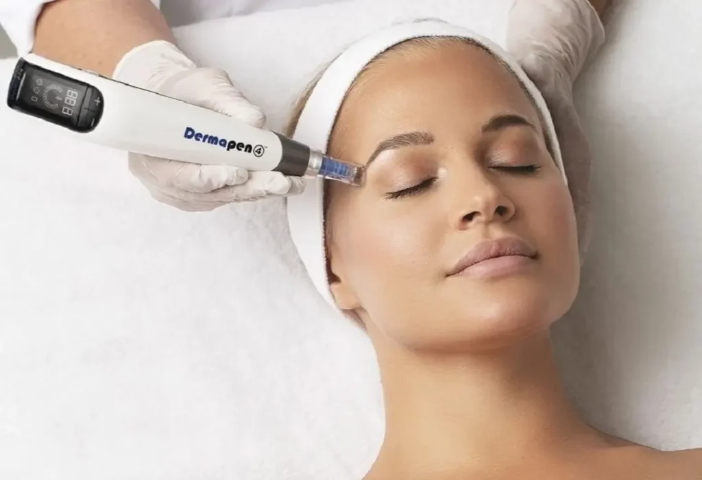 Tratamiento Dermapen® en Barcelona