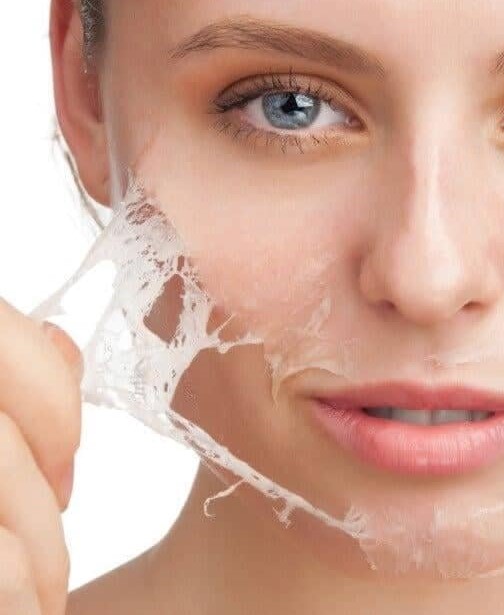 peeling-quimico-facial