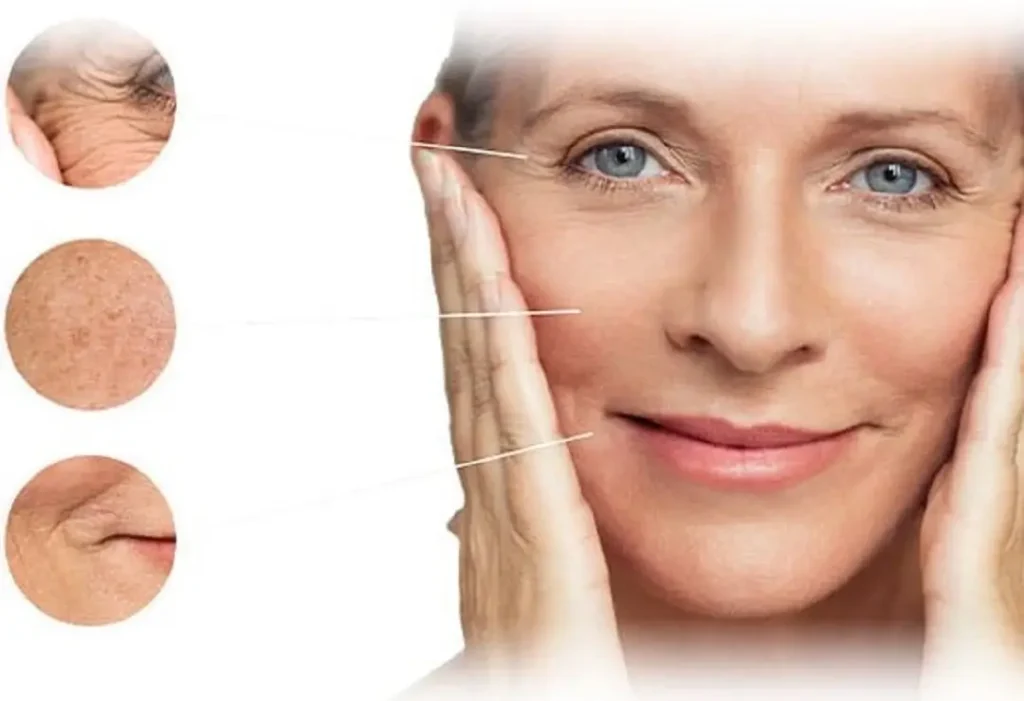Plasma para rejuvenecimiento facial