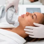 HIFU facial con Ultraformer III: qué es, cómo funciona y qué resultados esperar en Barcelona