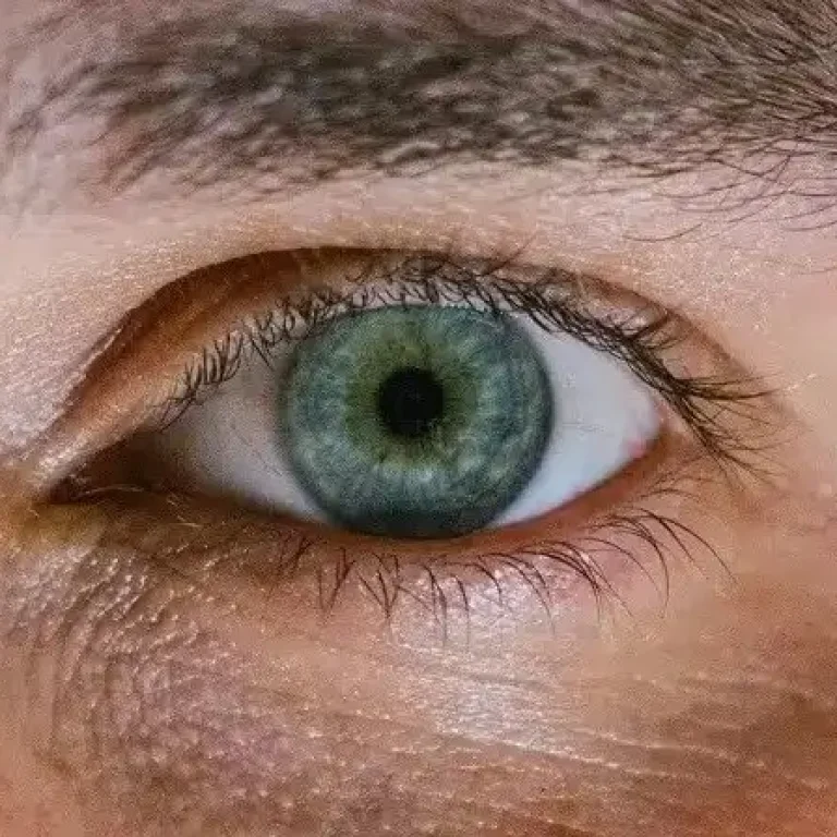 blefaroplastia-sin-cirugia