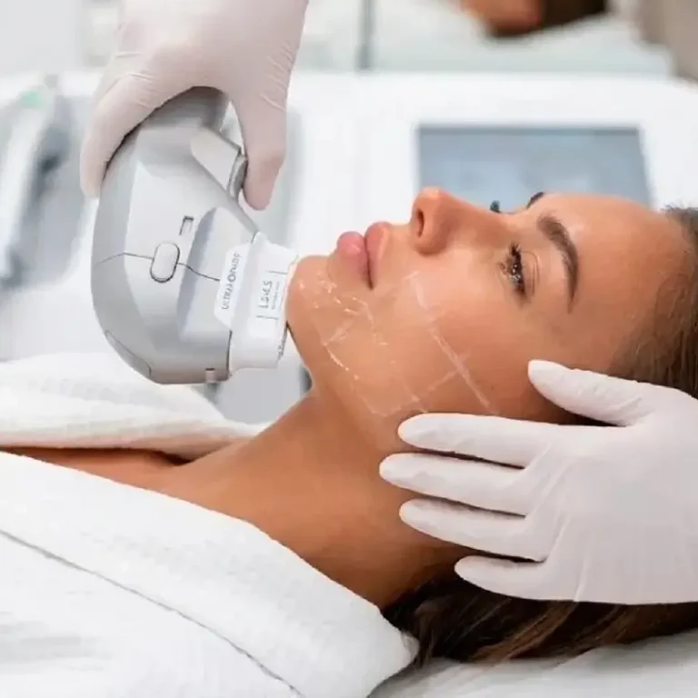 HIFU facial con Ultraformer III: qué es, cómo funciona y qué resultados esperar en Barcelona