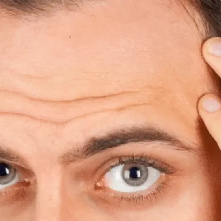 deja de perder el cabello
